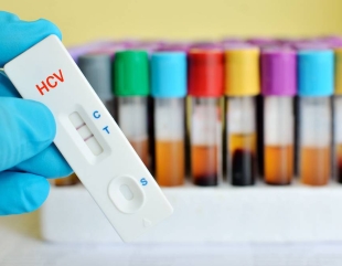 Tratamente și analize gratuite pentru persoanele neasigurate medical