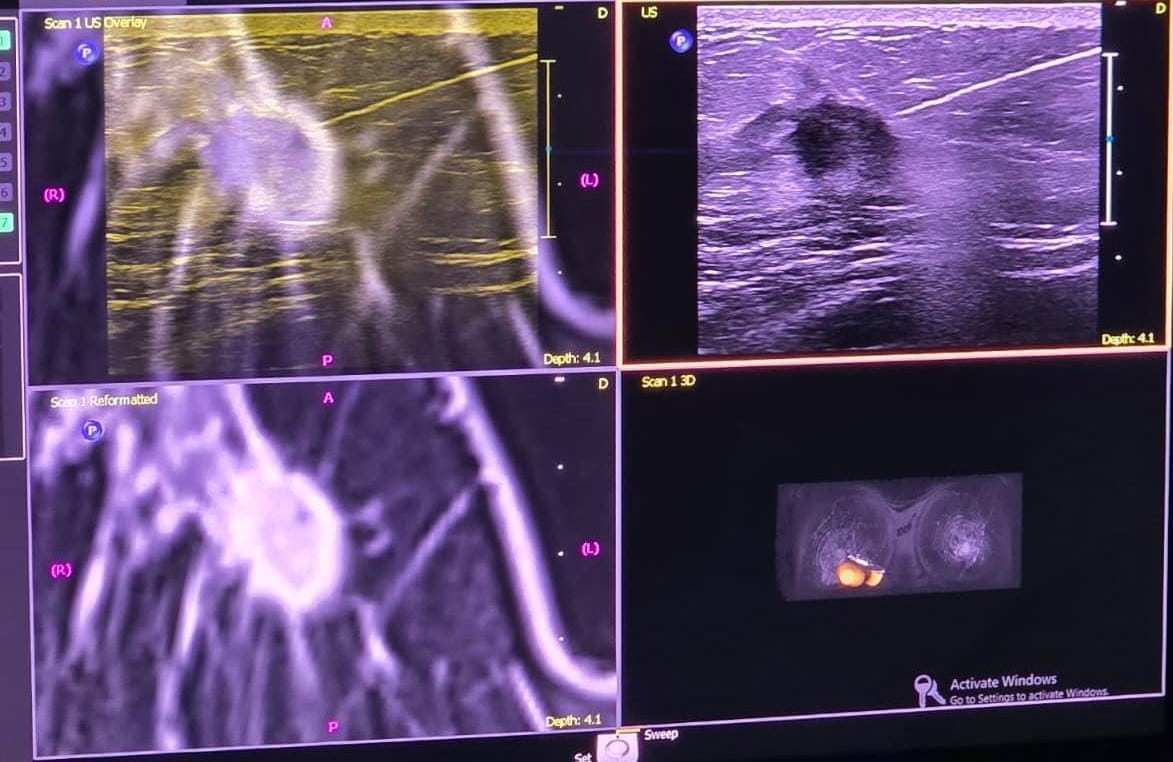Constanța intră în liga marilor centre medicale: proceduri inovatoare și laborator modernizat la Spitalul Județean