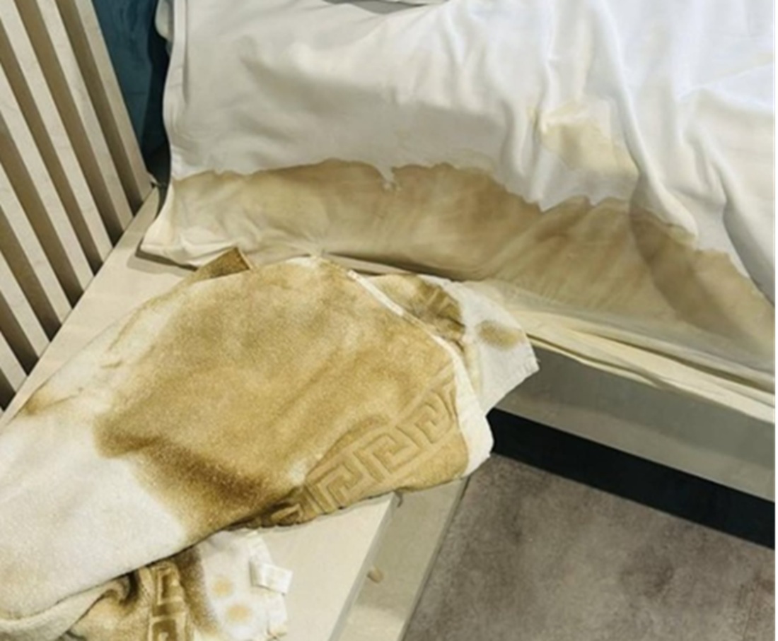 Taxă de 50 de lei pentru un prosop pătat. Decizia unui hotel din Mamaia a împărțit internetul în două tabere